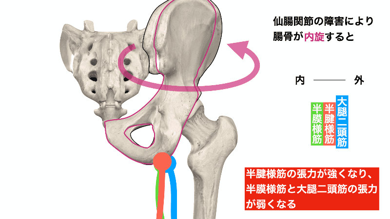 骨盤の偏位と筋肉の収縮