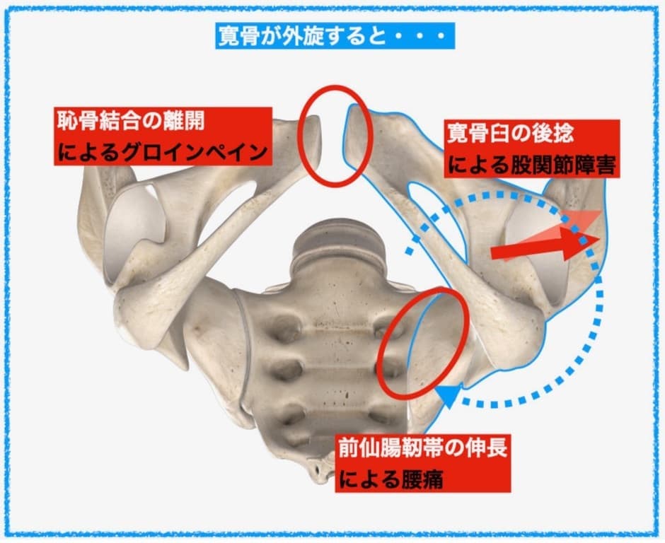 腸骨の回旋
