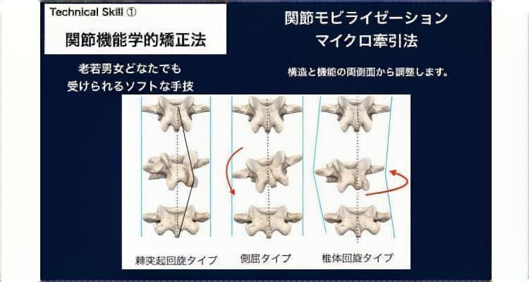 微細な関節運動の調整
