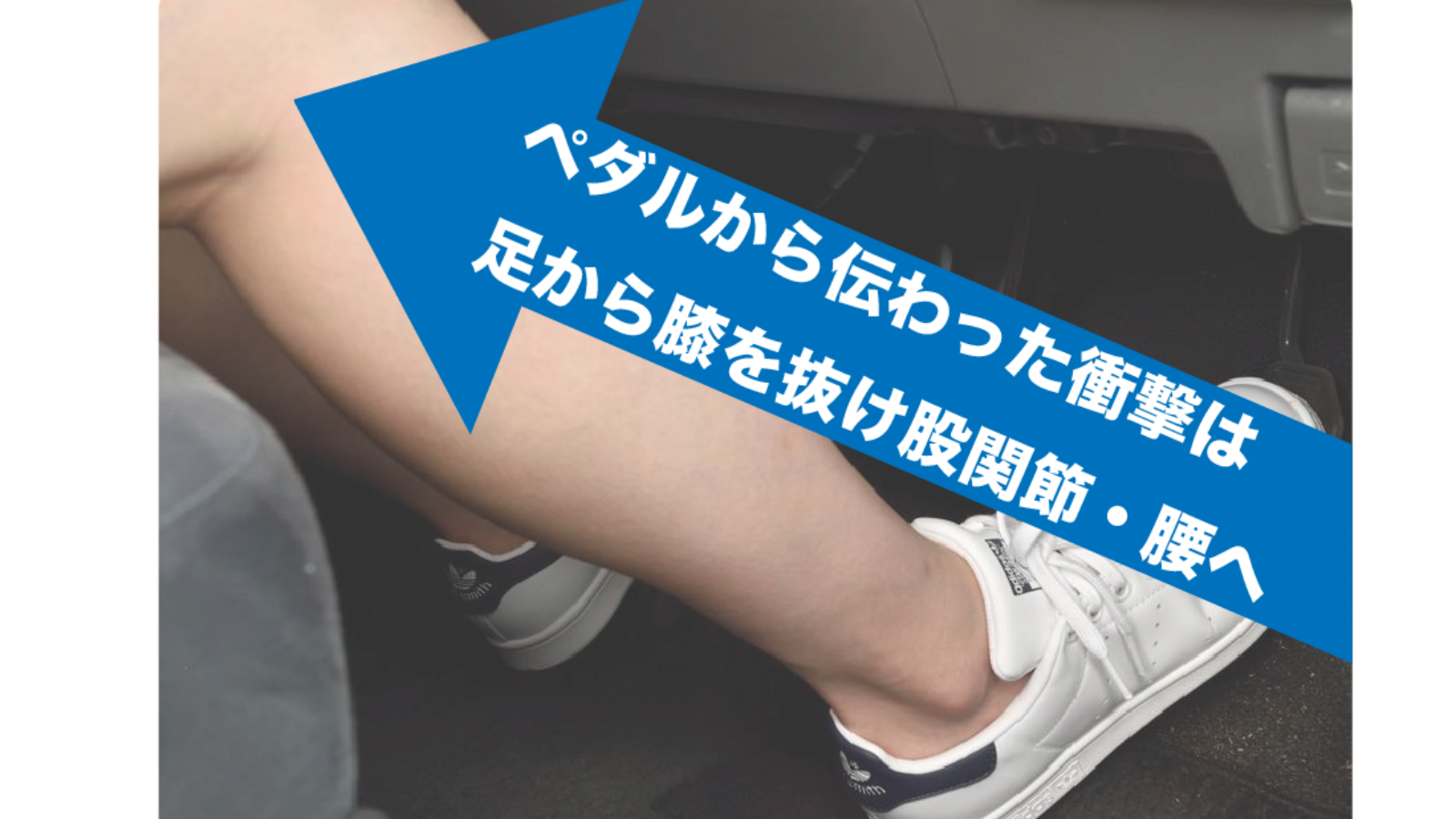 交通事故時の股関節