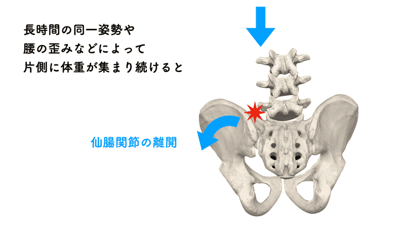 仙腸関節へのストレス