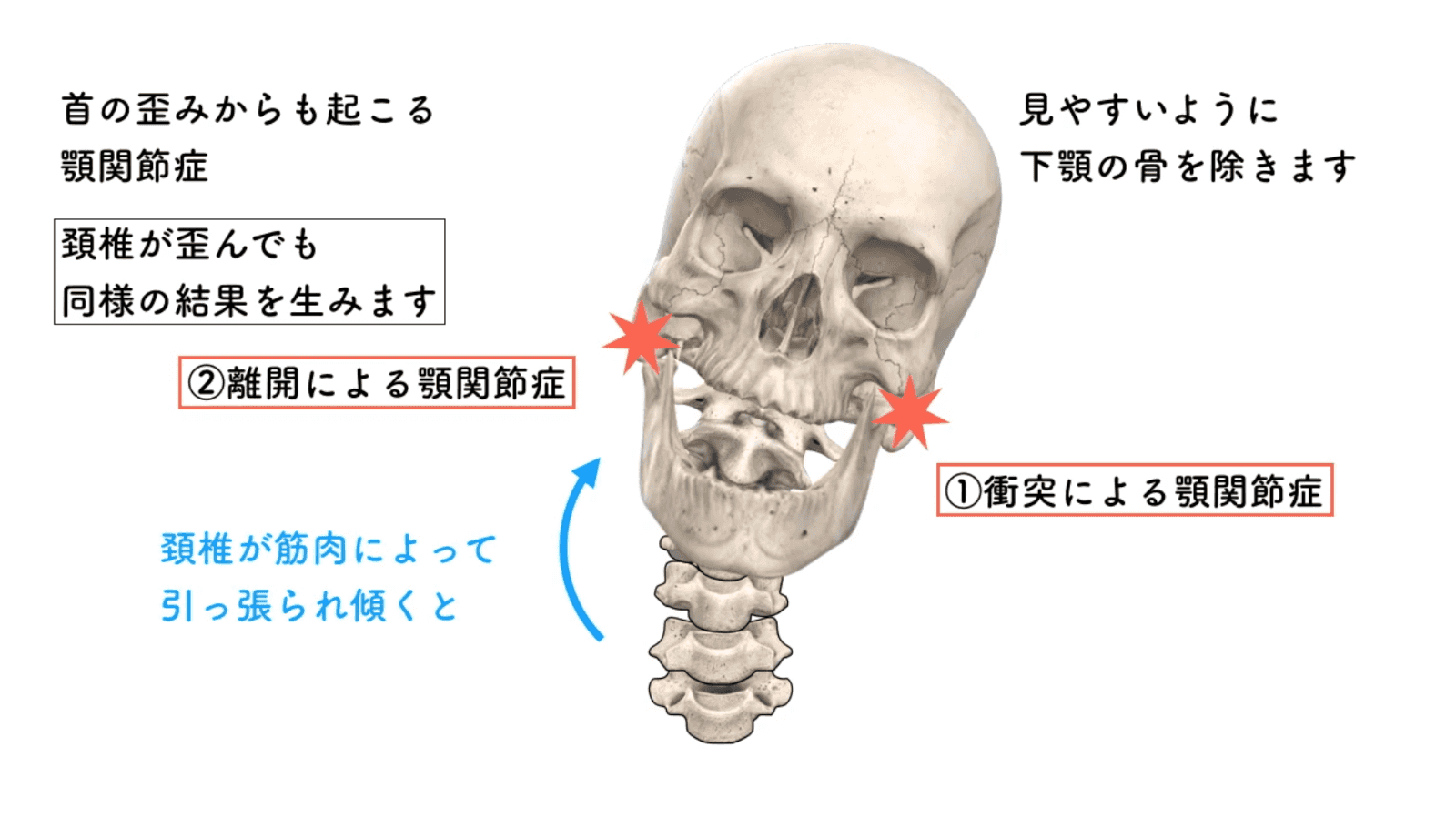 フィシオエナジェティック TMJ2 頭蓋下顎障害と顎関節症　テキスト フィシオエナジェティック TMJ2 頭蓋下顎障害と顎関節症 テキスト