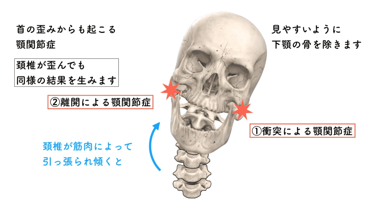 重力と顎関節の関連