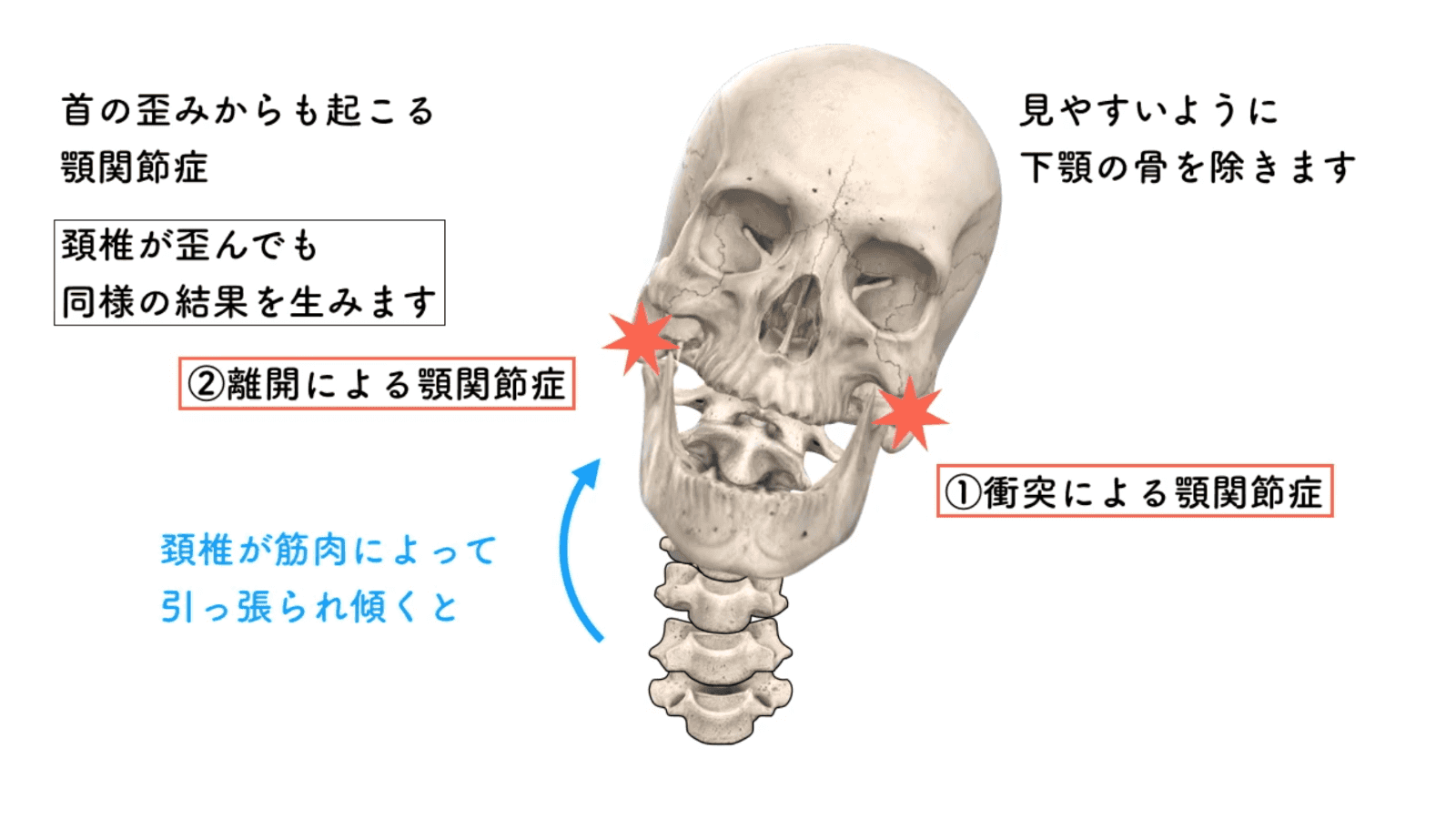 フィシオエナジェティック TMJ2 頭蓋下顎障害と顎関節症　テキスト 顎関節症・嚥下障害