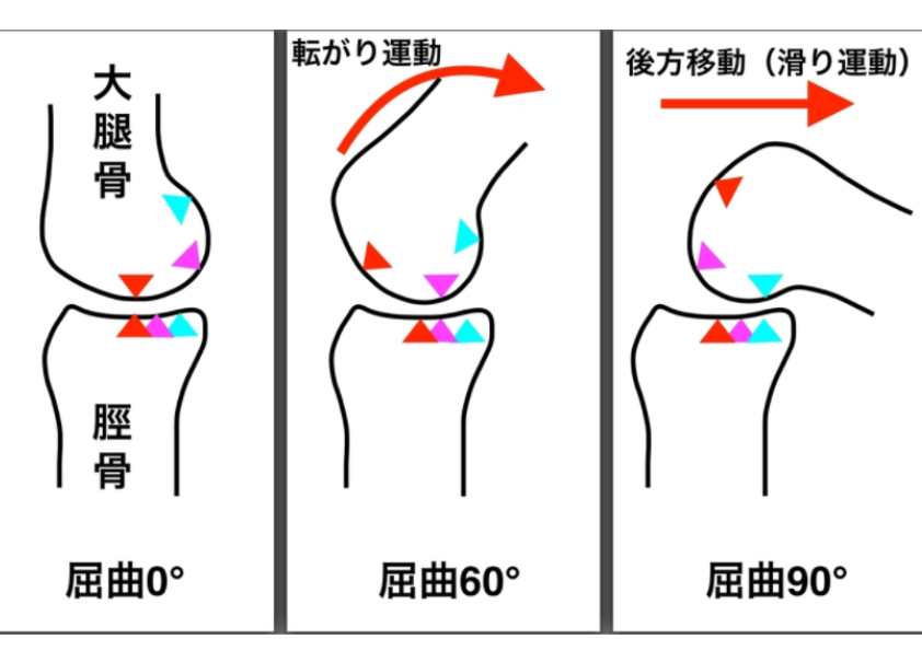 膝関節の障害