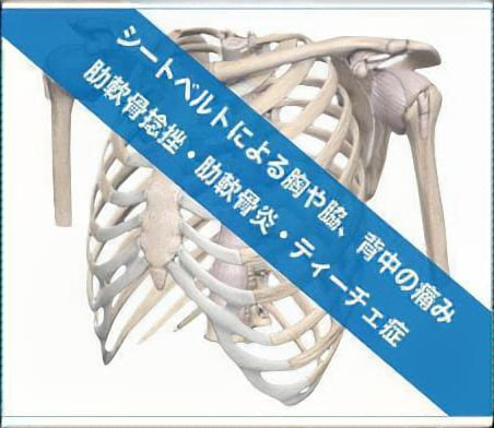 シートベルト損傷