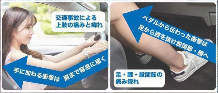 交通事故時の下肢への負担