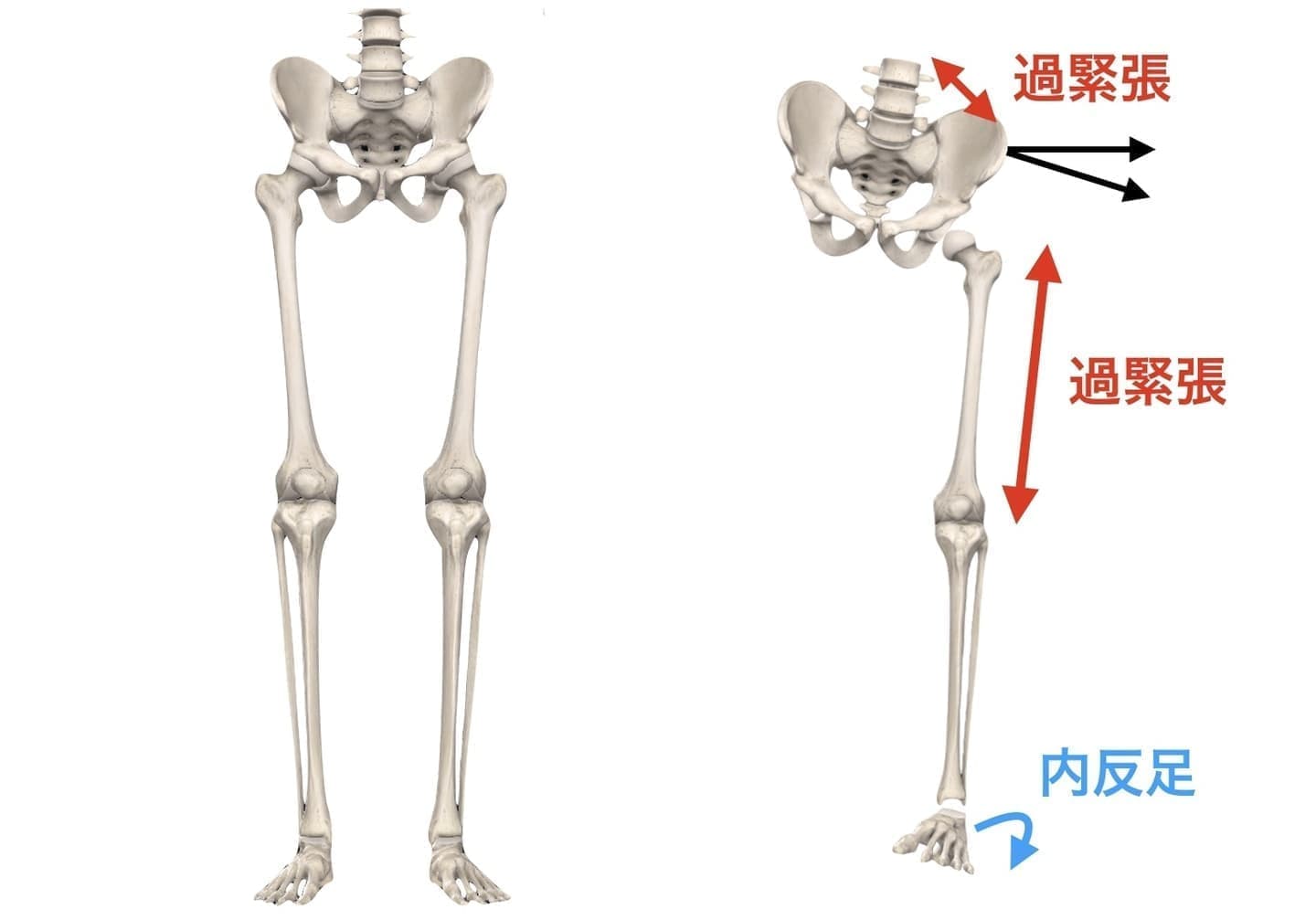 下肢の腰痛への影響
