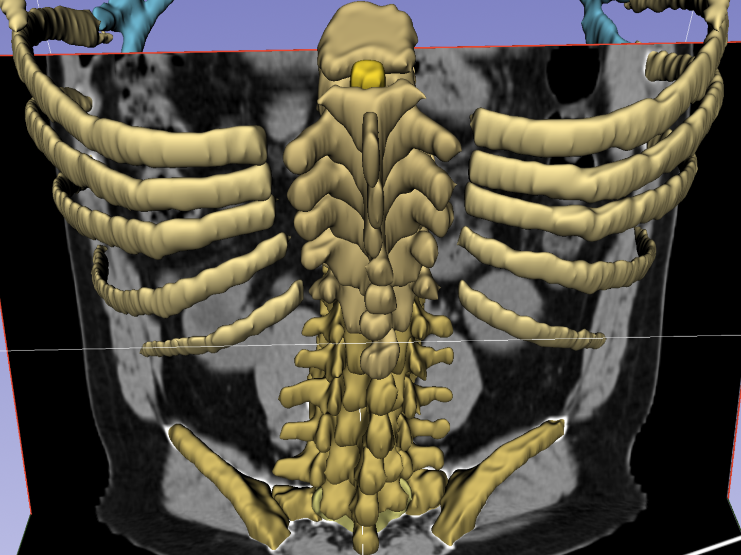 仙腸関節の不安定性