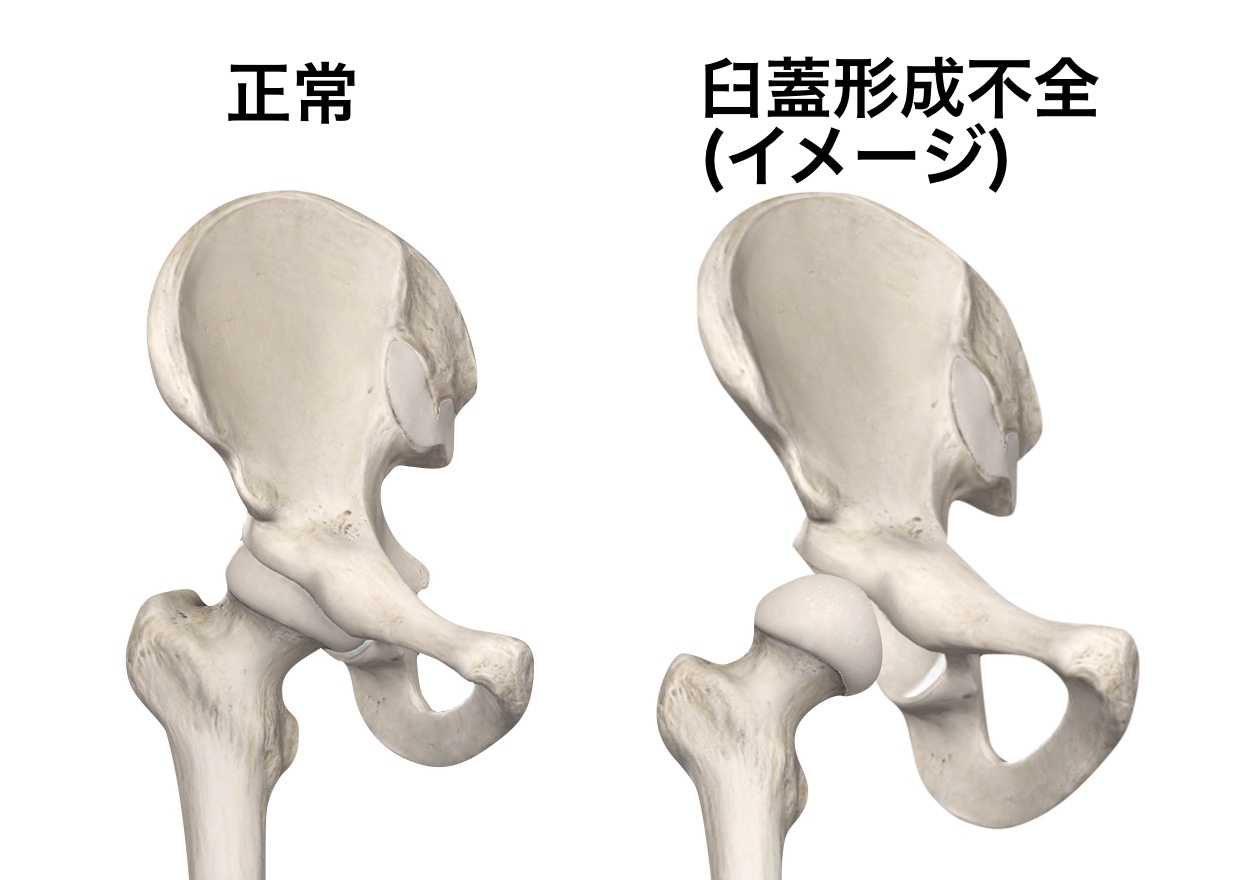 股関節学 612Ak2FAD2L._UF1000,1000_QL80_.jpg